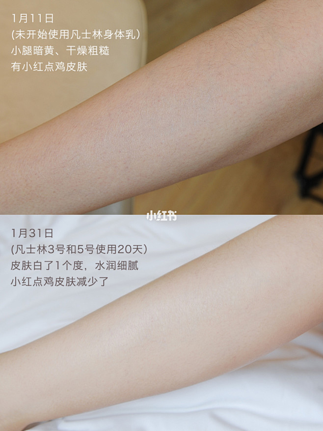 真的是神仙身体乳啊❗️美白去鸡皮❗️超能...