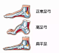八大因素危害足部健康 : 脚部受力约为体重的120%。美国芝加哥大学足病专家巴特盖斯特沃思博士表示，肥胖会改变脚部承受压力的方式，容易导致足底筋膜炎和脚跟疼痛，也会加重槌状趾和拇囊炎。 _教材配图_T20191115 #率叶插件，让花瓣网更好用_http://ly.jiuxihuan.net/?yqr=10146179#