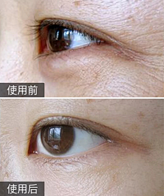王奇~采集到案例