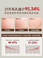 elk柚子面膜细腻毛孔紧致涂抹补水保湿滋润面膜雾屿森林柚子面膜-tmall.com天猫