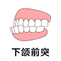 下颌前突