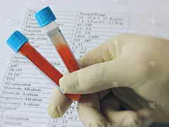 技术员,试管,报告,护手套,多糖症,导液管,试管婴儿,血糖过低,血红蛋白,胰岛素