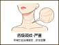 老化型颈纹 颈纹 颈部 去皱 去颈纹 嗨体去颈纹 肉毒素去皱 颈部抗衰 修复颈纹 紧致提升 干燥缺水 抚平颈纹 肉毒素去颈纹 伊肤泉去颈纹 去皱颈纹 玻尿酸去颈纹 激光去颈纹 微针去颈纹 超声刀去颈纹 颈纹针 肉毒素去颈纹
