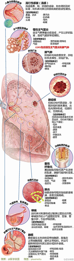 生命之毒采集到缩影