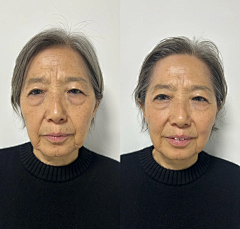 米修-jj采集到对比