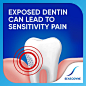 sensodyne-extra-whitening3