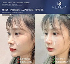 霏girl采集到案例水印