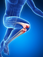 人体三维 3D 各种痛 透视骨骼 膝盖痛腿痛