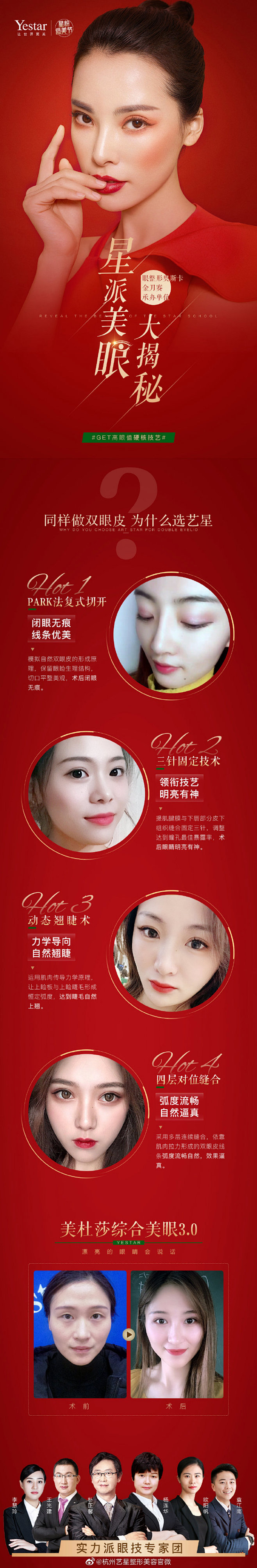 同样是做双眼皮
为什么美杜莎总美的过分
...