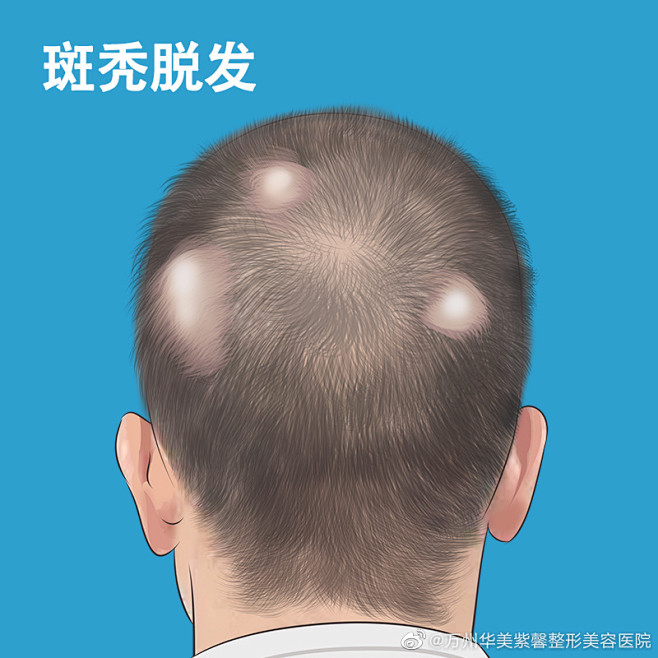 @万州华美紫馨整形美容医院 的个人主页 ...