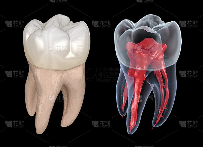 牙根解剖学-上颌第一磨牙。医学上准确的牙科3D插图