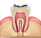 牙齿组织内部医疗图