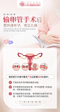 输卵管手术后科普海报-源文件