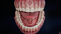 Teeth model - anatomical approach, Daniel Bauer : Set of teeth with major dental shapes and structures. Texturing is fully procedural,except the veins. I had a lot of fun in Marmoset TB to match dentin and flesh. Download a free decimated Model + Toolbag 