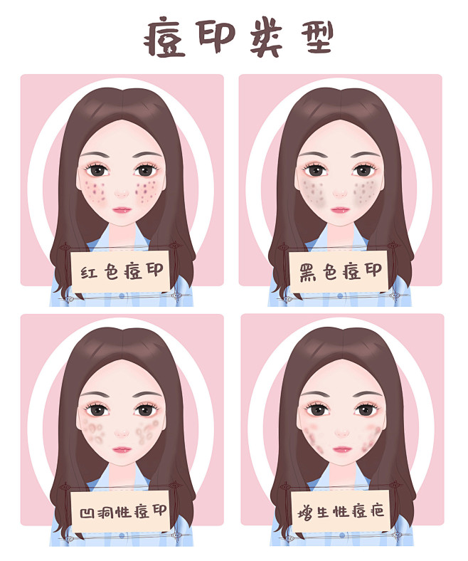 医疗插画—痘痘、斑等症状组图_戴超_【68Design】