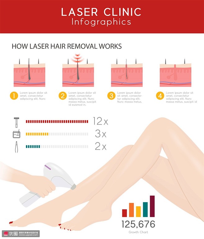 腿部脱毛 激光仪器 图例演示 整形插图插...