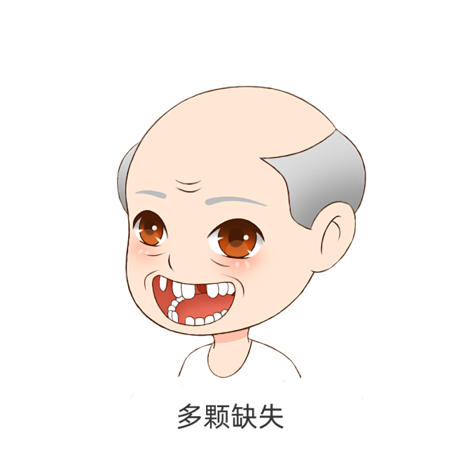 牙齿缺失人物（男）-多颗牙缺失