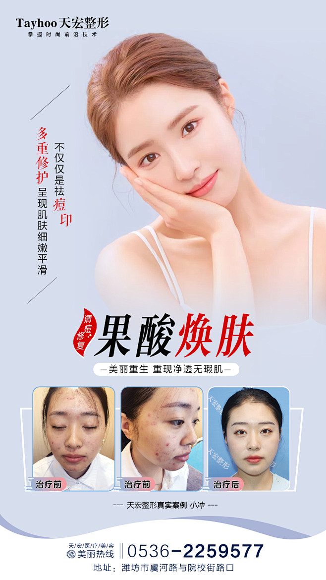 果酸焕肤案例