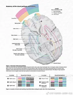 【学生组 解剖和病理宣教/教学类】视觉通路及病变的解剖学研究 Anatomy of the visual pathway and lesions  这幅医学插画描述了视觉通路的解剖结构和功能损失（如有损坏的话），适合于医学教科书。作者的挑战是定义和解决在以前的插图中存在的视觉问题。现有的插图表现了大脑二维横断面上的视觉 ​​​​...展开全文c