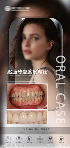 口腔贴面修复移动端海报-源文件-志设网-zs9.com