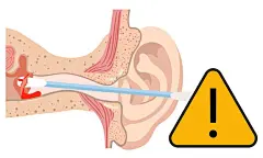 The reason not to use qtip for earwax removal