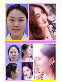 年轻时的无华采集到案例