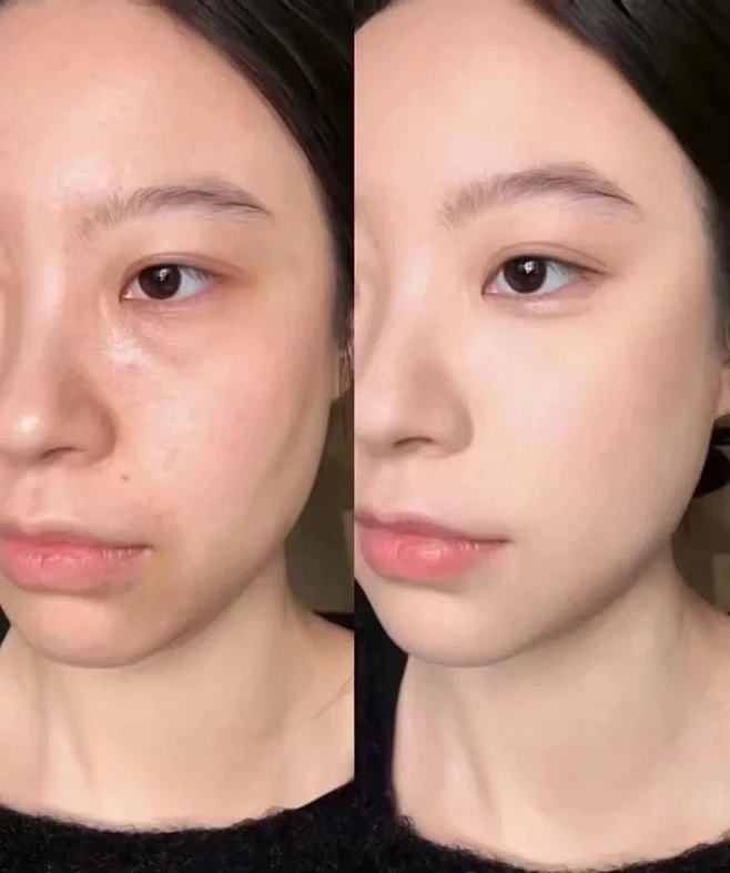可以不整容 但请一定要做抗衰图片_设计：案例图片素材-花瓣网