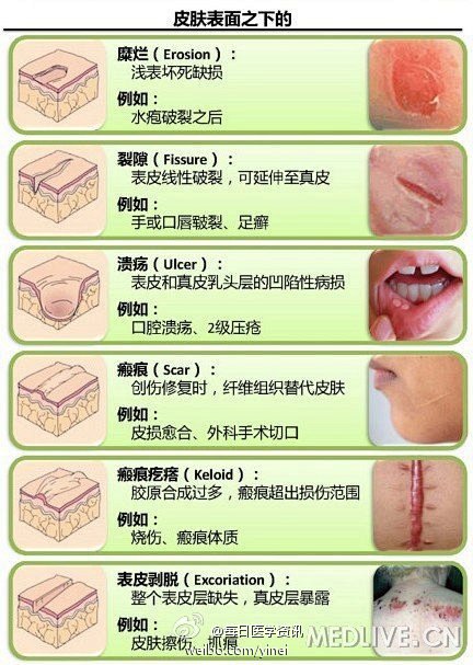 【多图读懂】皮肤病损的命名，来源医脉通。