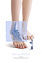 脚部骨骼 透视拍片 数字化医疗 医疗健康海报PSD62