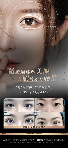 我爱吃西瓜55采集到双眼皮