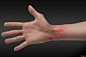 Mauricio Ruiz Design - NCIS: New Orleans - Wrist Scars : Some quick Concept Art of healed wrist scars found on a drowned soldier for NCIS: New Orleans.