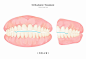 韩国简约牵引牙齿手绘素材牙齿矫正美容牙齿健齿插图插画设计PSD-淘宝网