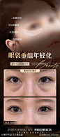 医美祛眼袋案例对比海报-源文件-志设网-zs9.com