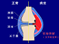 热敷“治疗”关节疼，真有那么神奇吗？-搜狐健康!!!