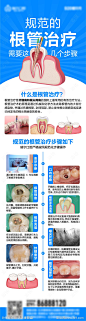 根管治疗流程-源文件-志设网-zs9.com