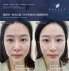 霏girl采集到案例水印