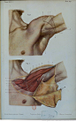 Traité d'anatomie topographique, 1869. Région axillaire. Dessiné d'après nature par J. Sarazin.