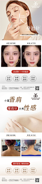 医美案例对比图-素材库-sucai1.cn