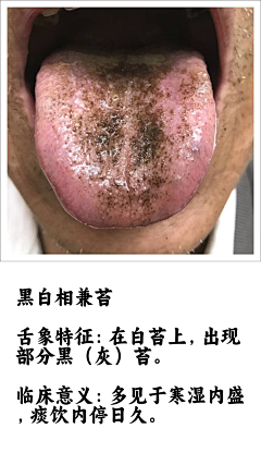 阿宅学医记采集到舌诊图