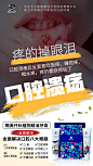 口腔溃疡