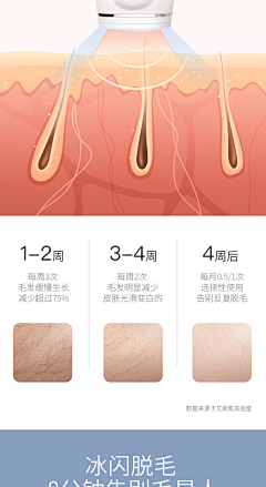 香了个菇采集到科普类医美