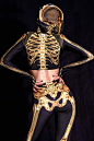 Golden Skeleton Matching Set : No grave can hold yo body down. Come back to the party in this powerful rave-vibing Halloween set printed with a luminous gold skeleton on a silken black background. It includes a hooded long-sleeve crop top and a pair of an