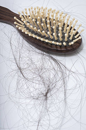 Hair loss