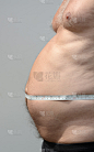 肥胖男性腹部轮廓用卷尺测量