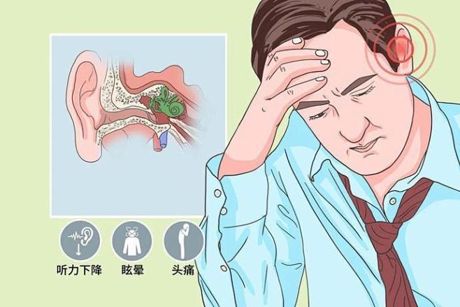 百度识图搜索结果-耳鸣