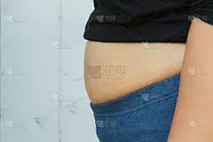 大腹便便的胖女孩