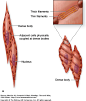 http://histonano.com/books/Junqueira%27s%20Basic%20Histology%20PDF%20WHOLE%20BOOK/10.%20Muscle%20Tissue.htm