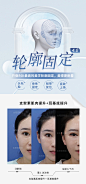 轮廓固定