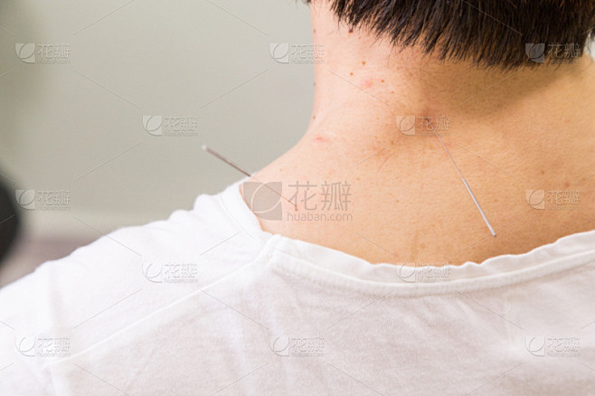 皮肤,深的,针灸针,浅的,针灸师,针灸,中医,水平画幅,健康,部分