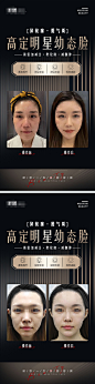 幼态脸案例海报-志设网-zs9.com